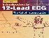 INTRODUCTION TO 12-LEAD ECG: THE ART OF INTERPRETATION. 2/E 2015 - 1284040887